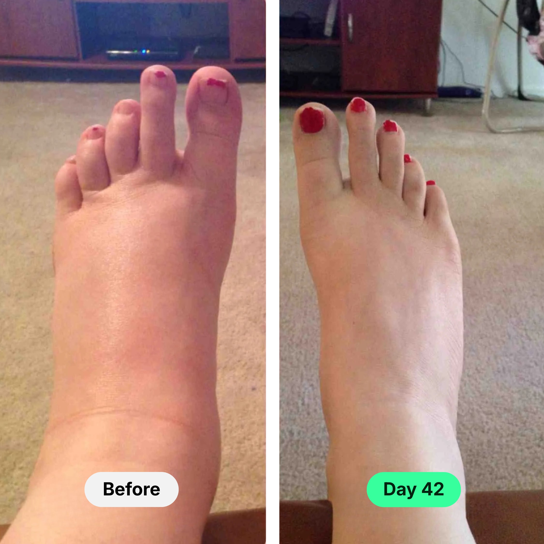 Lymphatic Drainage Drops